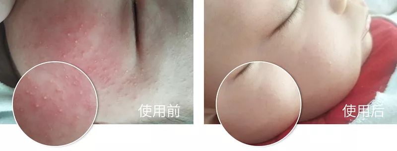 凤凰网梧桐汇商城|皮肤干痒、开裂、脱皮?用它抹一抹,立马见效