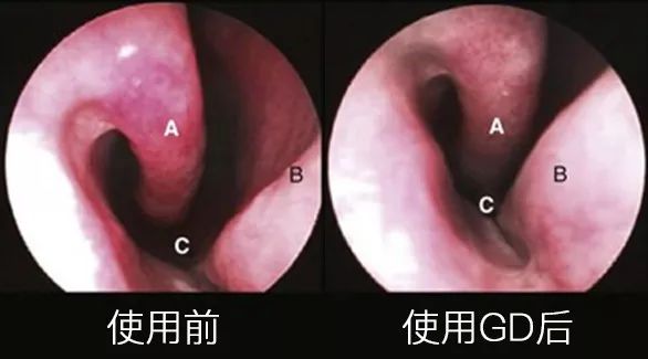 凤凰网梧桐汇商城|喷一喷摆脱鼻炎困扰,强效杀菌止痒通鼻修复鼻粘膜