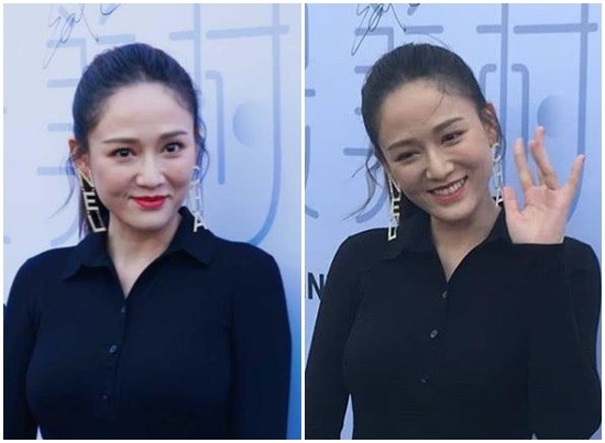陈乔恩关掉美颜滤镜后，脸上惊现多处凹陷