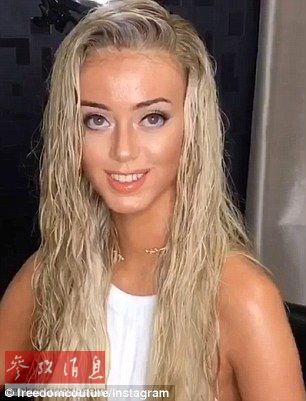 正量!女生少女脱下假发鼓励女性接受不完美的斑秃漂亮图片