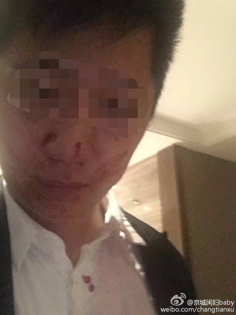 同主题阅读:饿了么ceo被指一言不合就打人 伤者鼻骨骨折