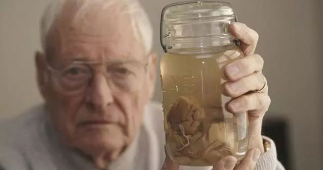 私藏爱因斯坦大脑43年背后不为人知的故事