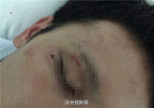 越南否认殴打中国公民 称“是当事人自己摔伤的”