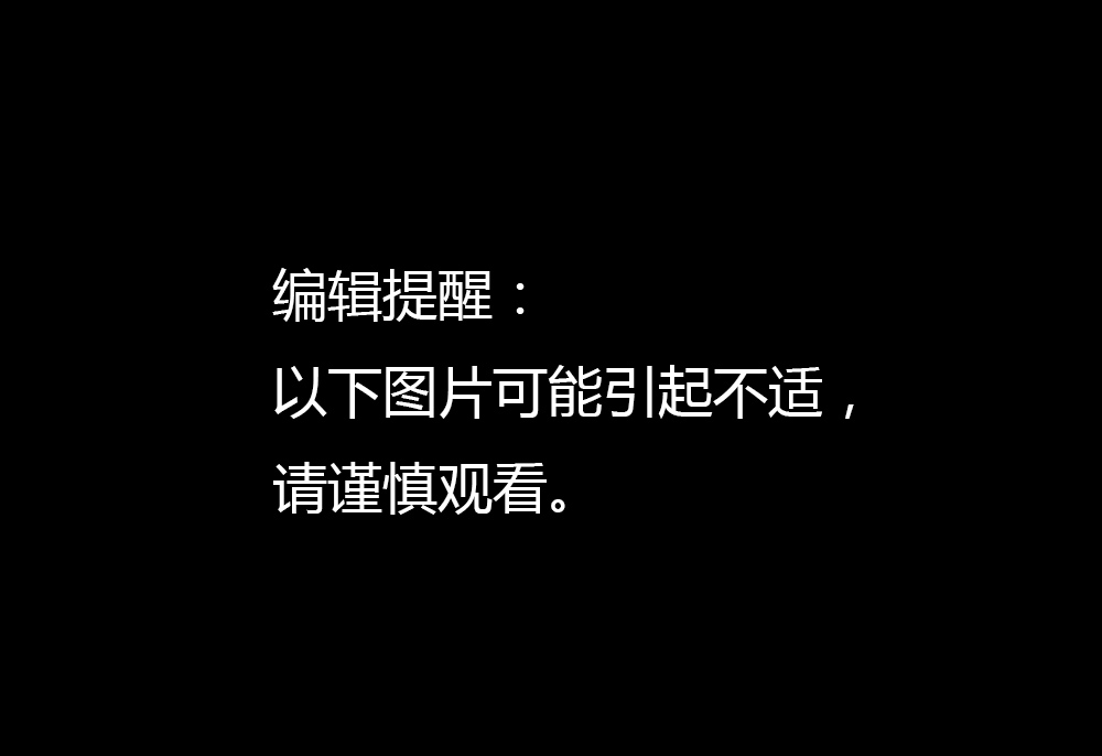 叙利亚遭战机毒气突击现场(组图)
