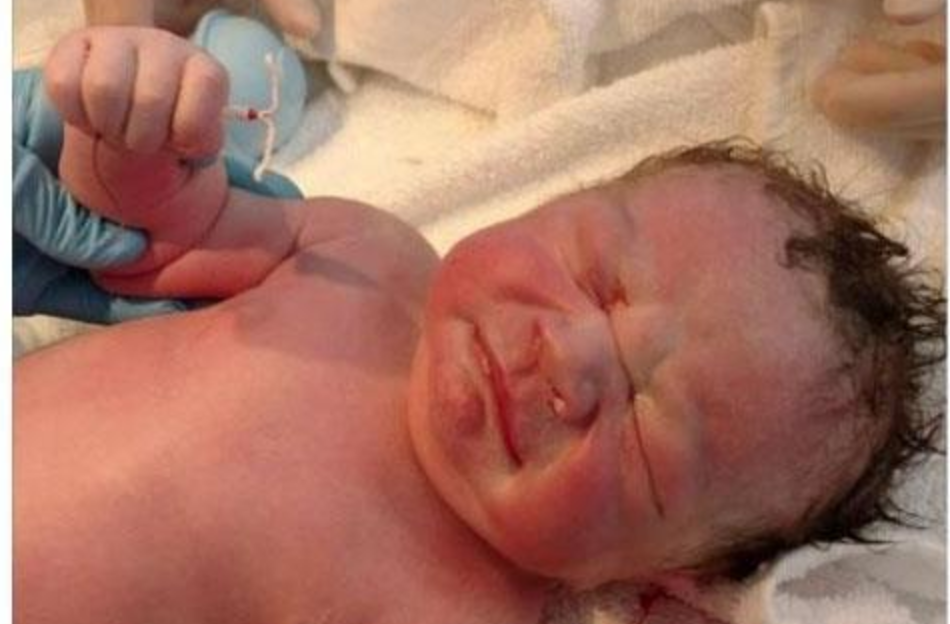 婴儿握避孕环出生 竟还摆出KO手势