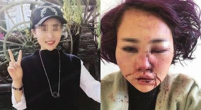 丽江“女游客遭殴打”案今日9时一审公开开庭审理