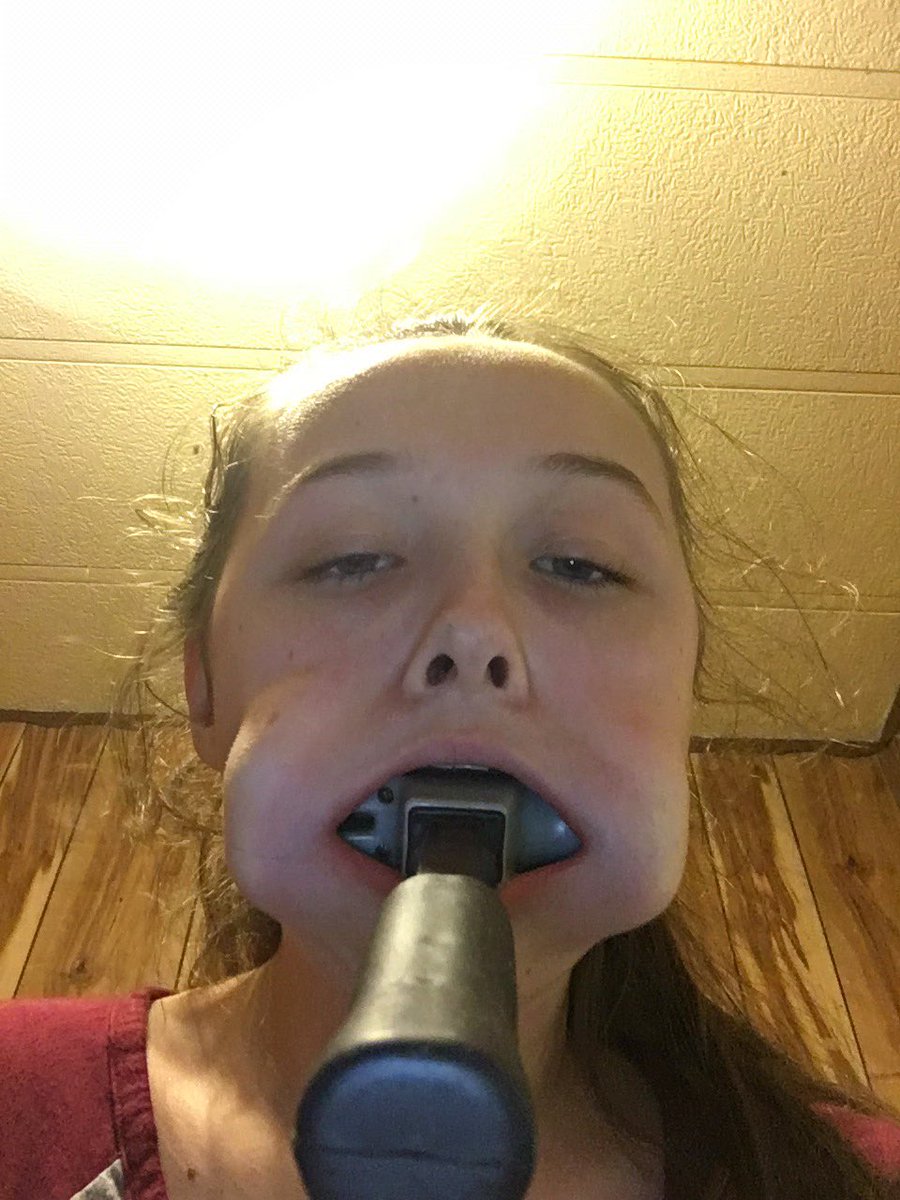 14岁少女为了向韩国男团示爱把铁锤塞进嘴里_手机凤凰网, image size:900x1200