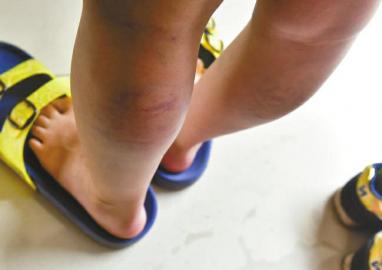 腿上、手臂上都是伤痕。