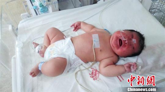 江苏常州一孕妇顺产12.5斤巨婴 患病正治疗