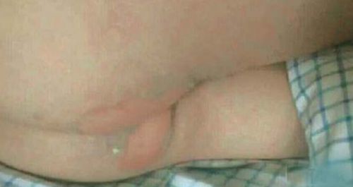 网友爆料帖附的照片显示，被打学生的屁股有红肿迹象。（网友供图）