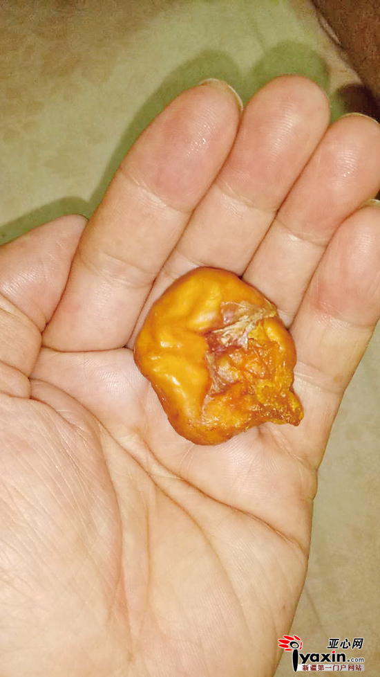 朱先生花50块钱买了只三黄鸡，宰鸡时从鸡的胸腔部位掏出来一个肉疙瘩，怀疑是“鸡宝”。 朱先生提供