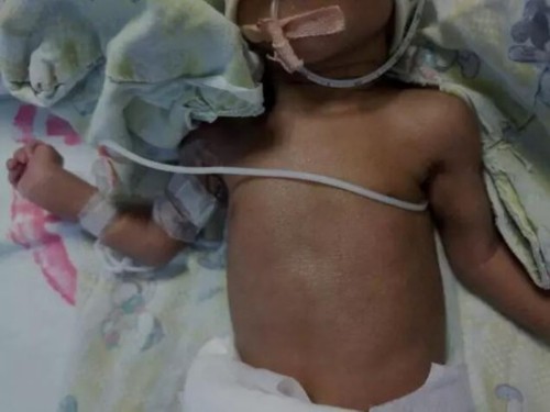 在福州沿海地区,一对夫妇皮肤白净,生下的二胎儿子却全身黝黑,像个非洲人