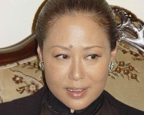 女星不是脸上长大痣都丑!说不定还是福痣!