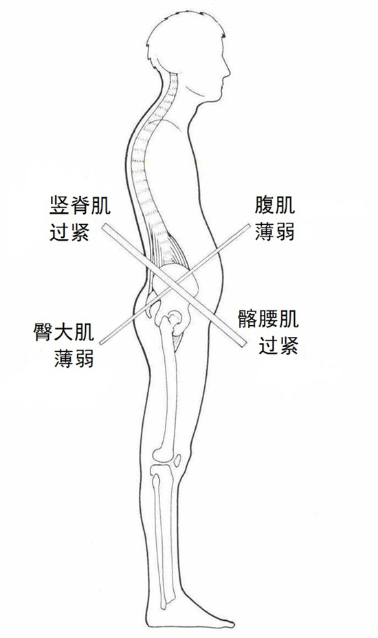 半岛棋牌世界脊椎日 关注哪些异常姿势伤了你的腰椎？(图2)
