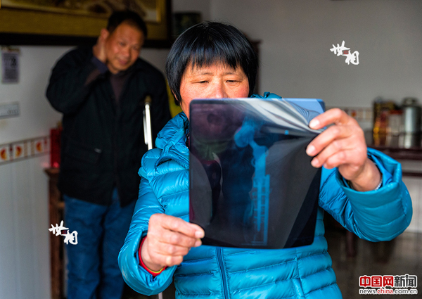 袁道荣正在查看丈夫的X光。