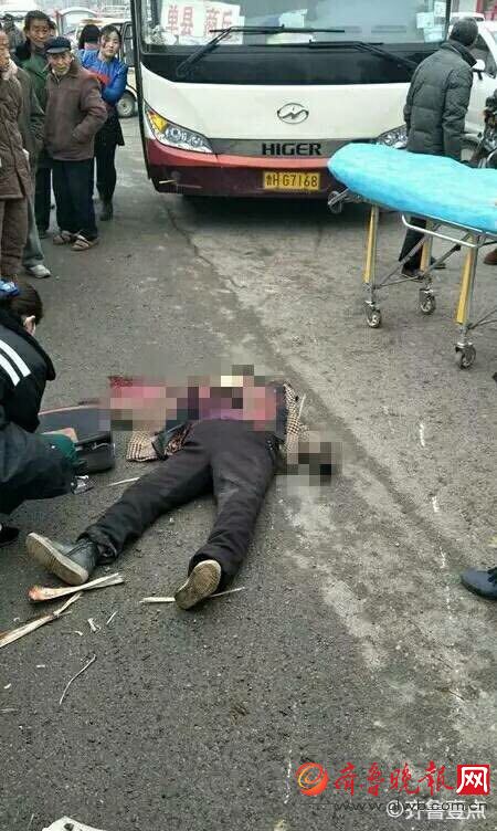 菏泽单县一妇女骑三轮车与客车相撞,生命垂危