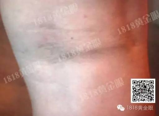 宁波一男子称被警方屈打成招:打四五小时逼我认罪