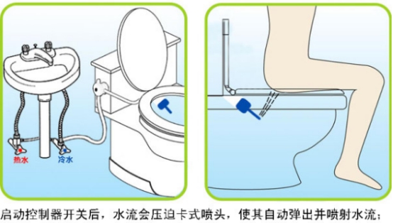 肛门湿疹怎么治 有哪些特点呢