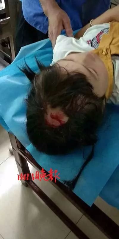 揪心!高空坠物砸中女童 发生了什么?谁该为这场