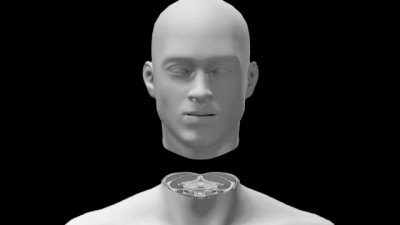 中国人首尝换头术? 中国专家:现在谈都是闲扯