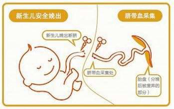 脐带血造血干细胞vs骨髓造血干细胞vs外周血造血干细胞