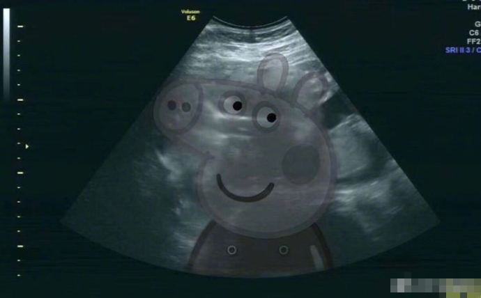 怀孕9周b超图片