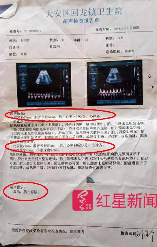 孕妇多次产检双活胎却只分娩一胎 医院：系误查_凤凰网