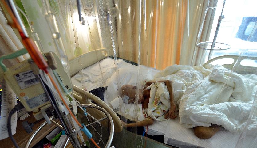 血癌男童术后排斥反应瘦成皮包骨只剩30多斤