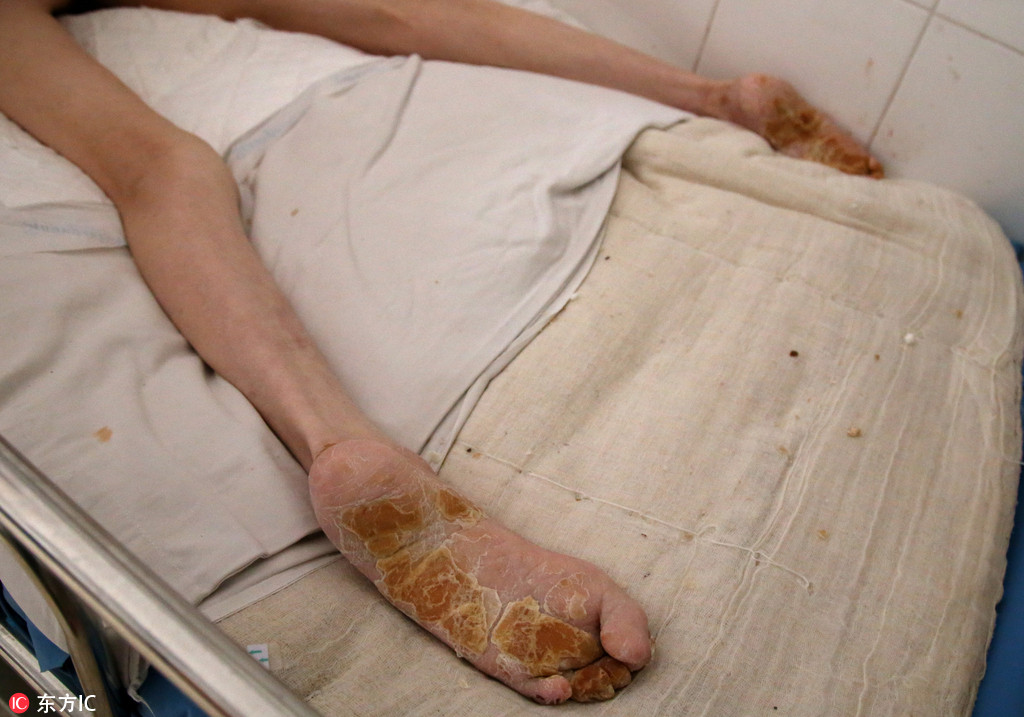湖南临澧一女子患奇病三年卧床不起 其夫坚称妻子曾遭遇"咒语"