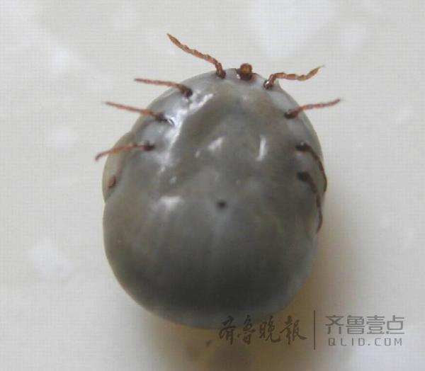 发热伴血小板减少综合征高发卫计委提醒防范蜱虫