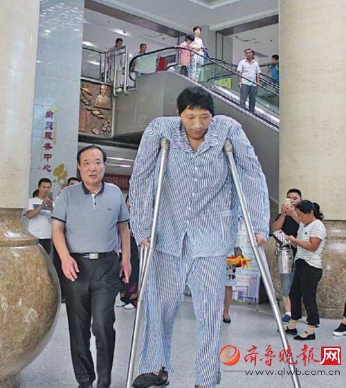 中国巨人症患者图片
