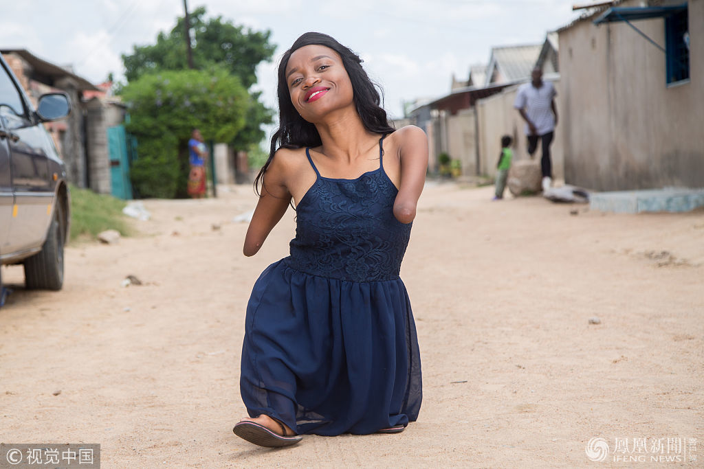 津巴布韦:四肢残疾的美发师